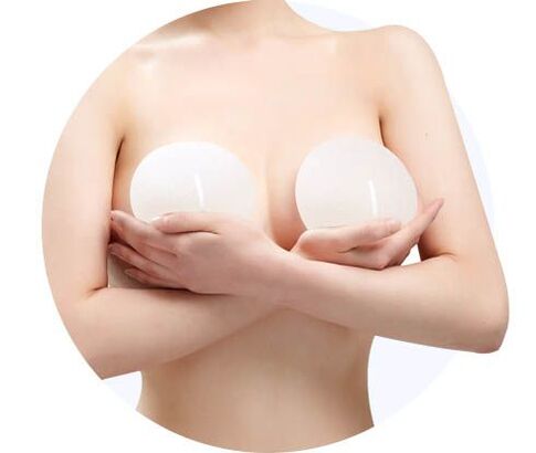 Aumento de mama com implantes